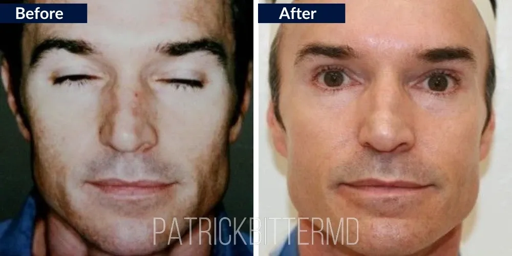 Skintyte Before & After