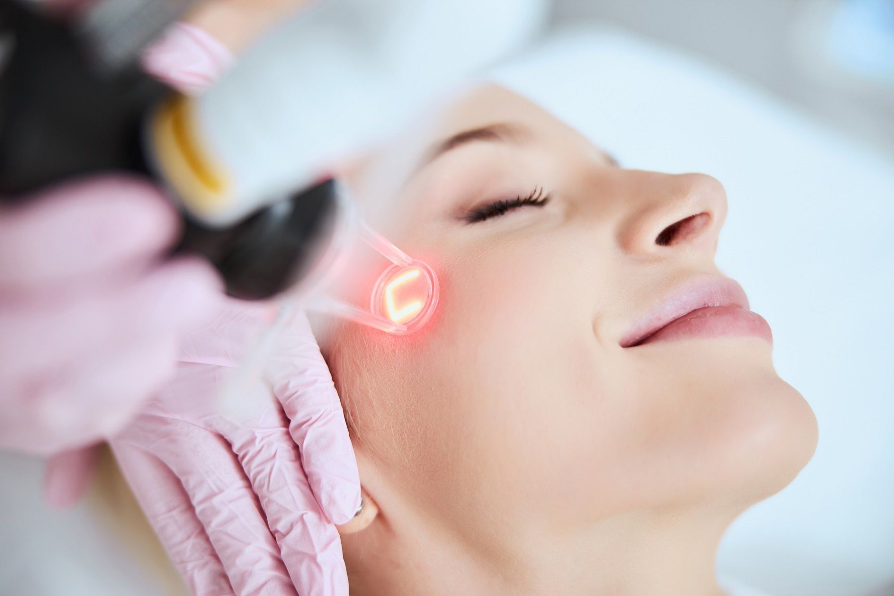 What Can You Expect During []the Halo Hybrid Fractional Laser Treatment?[]